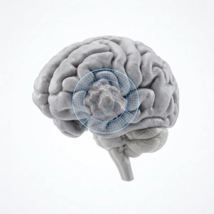 Brain Tumor Surgery