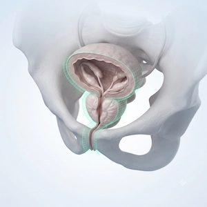 Prostate Surgery