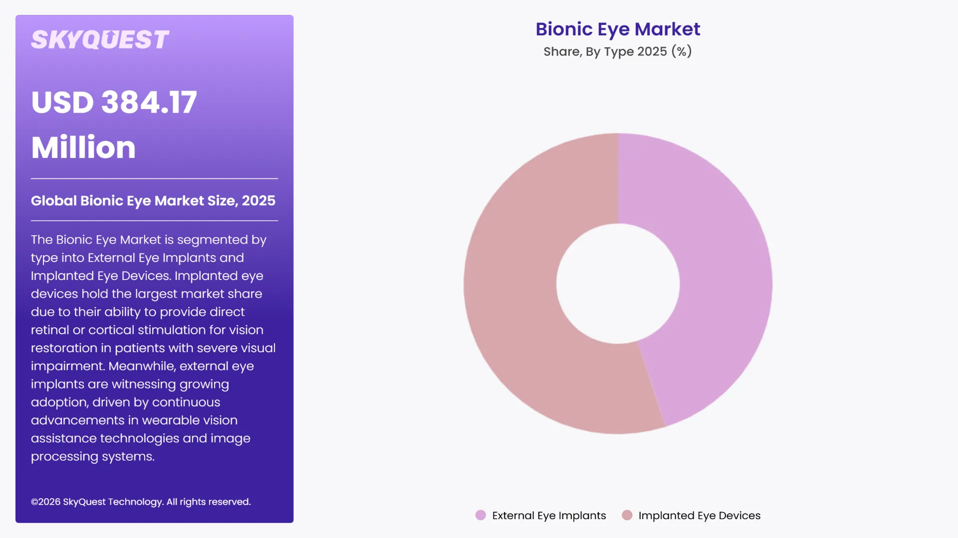 Bionic Eye Market By Segments