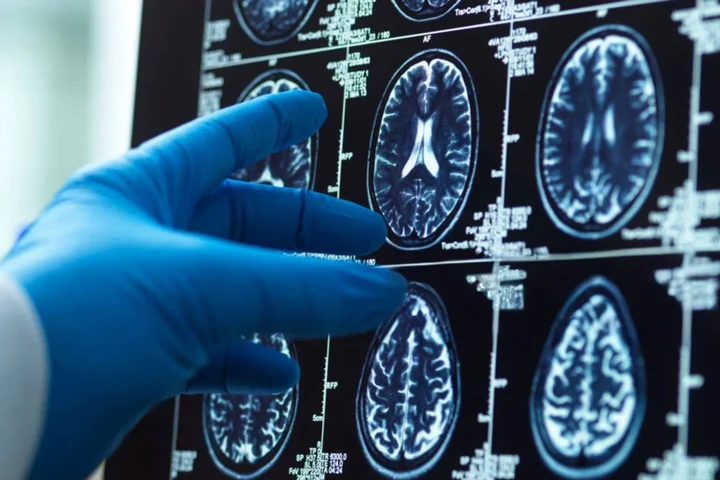 Discovery offers hope to children with rare and severe epilepsy