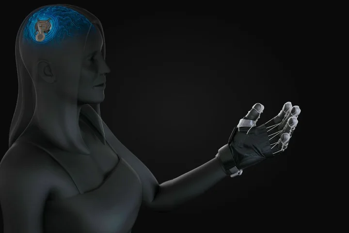 A New Implant Aims to Rewire the Brain to Help Stroke Patients