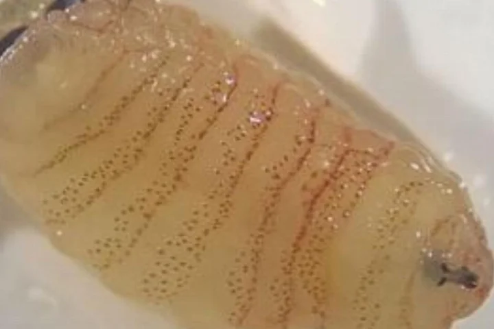 Woman starts sneezing out bugs after developing an infection