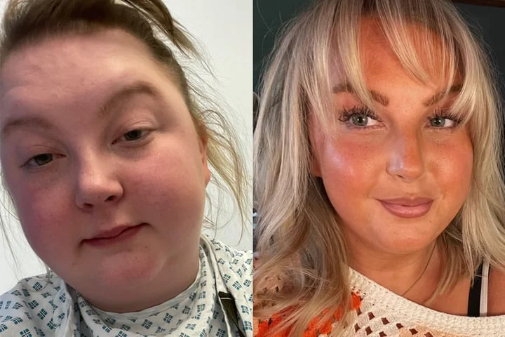 Woman who drank two litres of gin a day set to run half marathon for charity