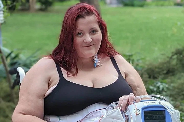 Shocking photo reveals giant ‘unfixable’ hernia in woman’s stomach