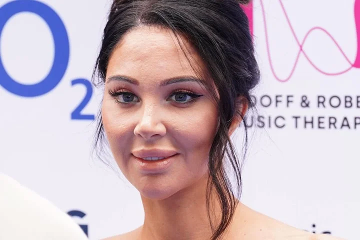 Tulisa reveals ‘minor’ but short-term paralysis after Bell’s palsy attack