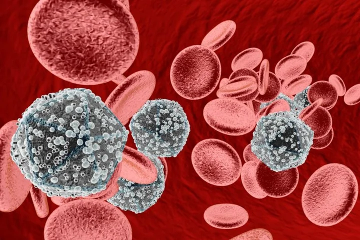 Man cured of HIV with transplant from his brother in world first procedure