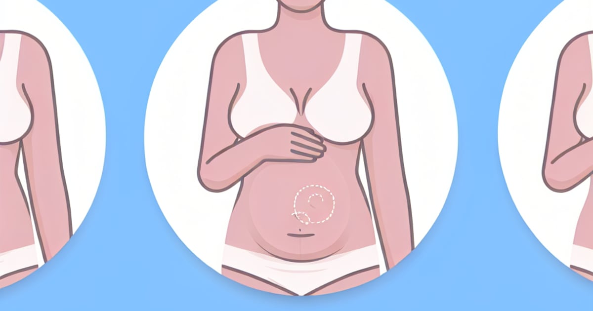 Early Pregnancy Symptoms: What to Expect - Blog Post