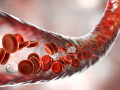 Натуральное средство, которое чистит сосуды, снижает артериальное давление и уровень холестерина