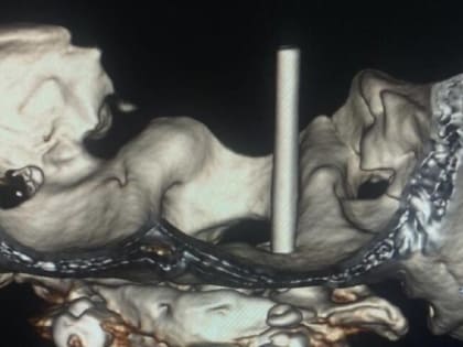 Уникальная операция спасла жизнь пациенту в Краснодаре