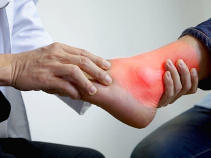 Как избавиться от подагры навсегда: доктор Мясников назвал лекарства, которые быстро выведут мочевую кислоту из вашего организма