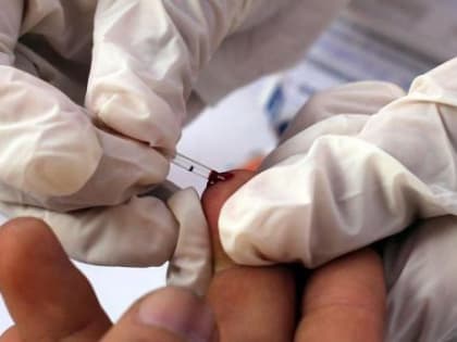 По итогам года количество ВИЧ-инфицированных на Кубани выросло более чем на 15%