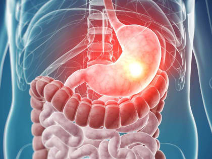 Утренние боли в желудке: какие ещё симптомы могут указать на рак пищевода