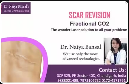  Dr Naiya Bansals Skin Laser Hair Transplant Clinic in Chandigarh, India, Punjab | PunjabsList