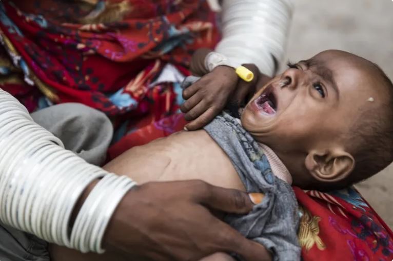 تھرپارکر: غذائی قلت مختلف امراض سے جاں بحق بچوں کی تعداد 50 ہوگئی