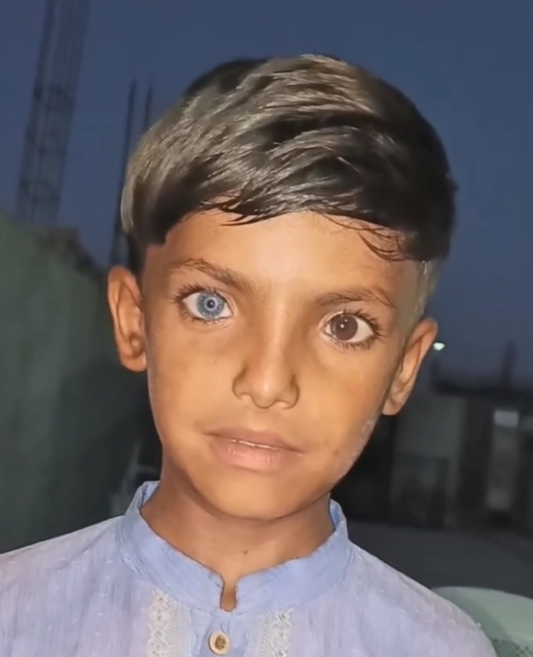 سانگھڑ کے بچے کی نایاب آنکھوں نے سوشل میڈیا پر دھوم مچا دی