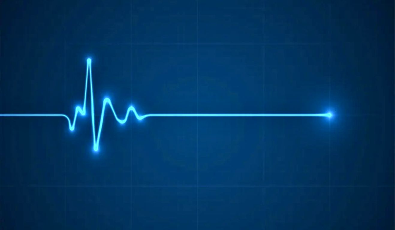 AI-Enabled ECG Screening Detects Previously Undiagnosed Heart Condition in Real-World Care