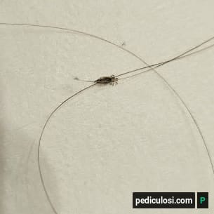 Foto verificata di un pidocchio, caso 13