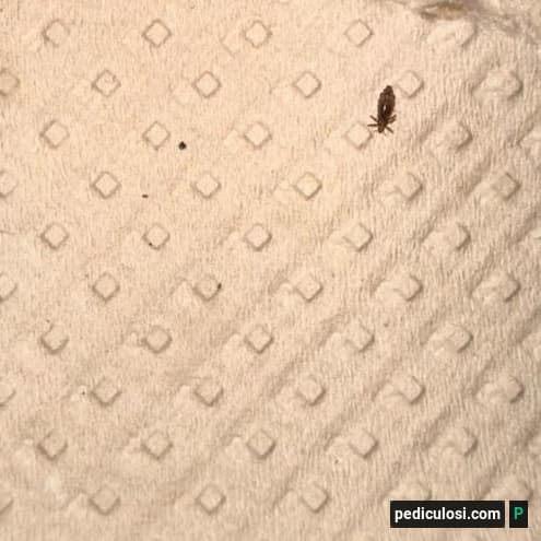 Foto verificata di un pidocchio, caso 9