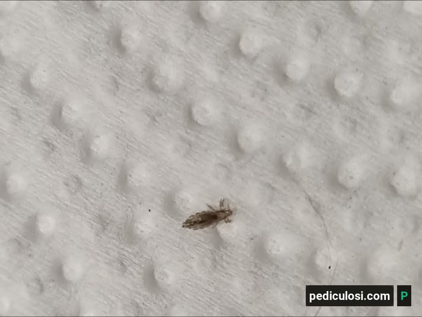 Foto verificata di un pidocchio, caso 21