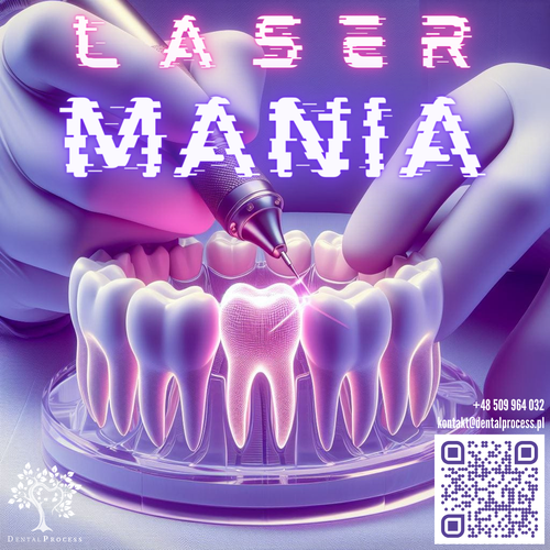 Laser Mania