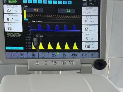 В Тольяттинскую больницу поступили новые аппараты ИВЛ