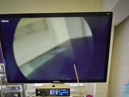 В Зарайске начнут проводить операции с цветной картинкой 4К на новом оборудовании!