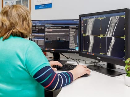 Столичные ученые разработали метод ранней диагностики рассеянного склероза с помощью нейросети