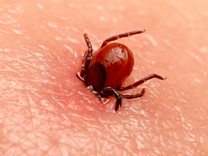 В Роспотребнадзоре обнаружен новый вирус Хасеки