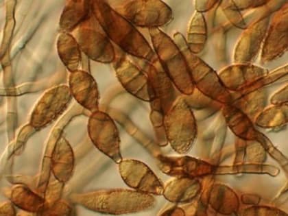 Грибы рода Alternaria обнаружены в ходе лабораторного анализа