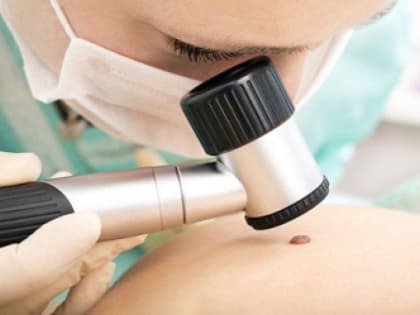 Бесплатно провериться на онкозаболевания кожи можно будет в Хабаровске