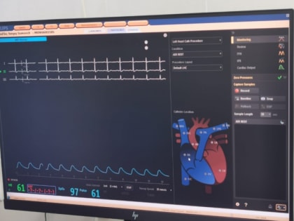 В Хабаровске растет число высокотехнологичных операций по удалению тромбов при инсультах