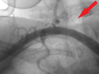 Хабаровские врачи спасли руку пациенту