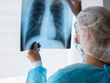 Туберкулез и ВИЧ: Как защитить свое здоровье