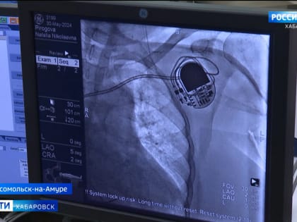 В Комсомольске-на-Амуре в сосудистом центре больницы им. Шевчук освоили установку кардиостимуляторов