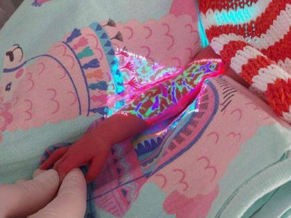 В перинатальный центр Хабаровска поступило новое оборудование