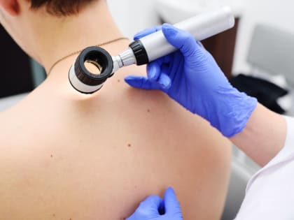 Провериться на онкозаболевания кожи можно в Хабаровске
