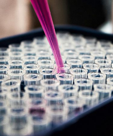 test tubes filled with liquid and a dropper