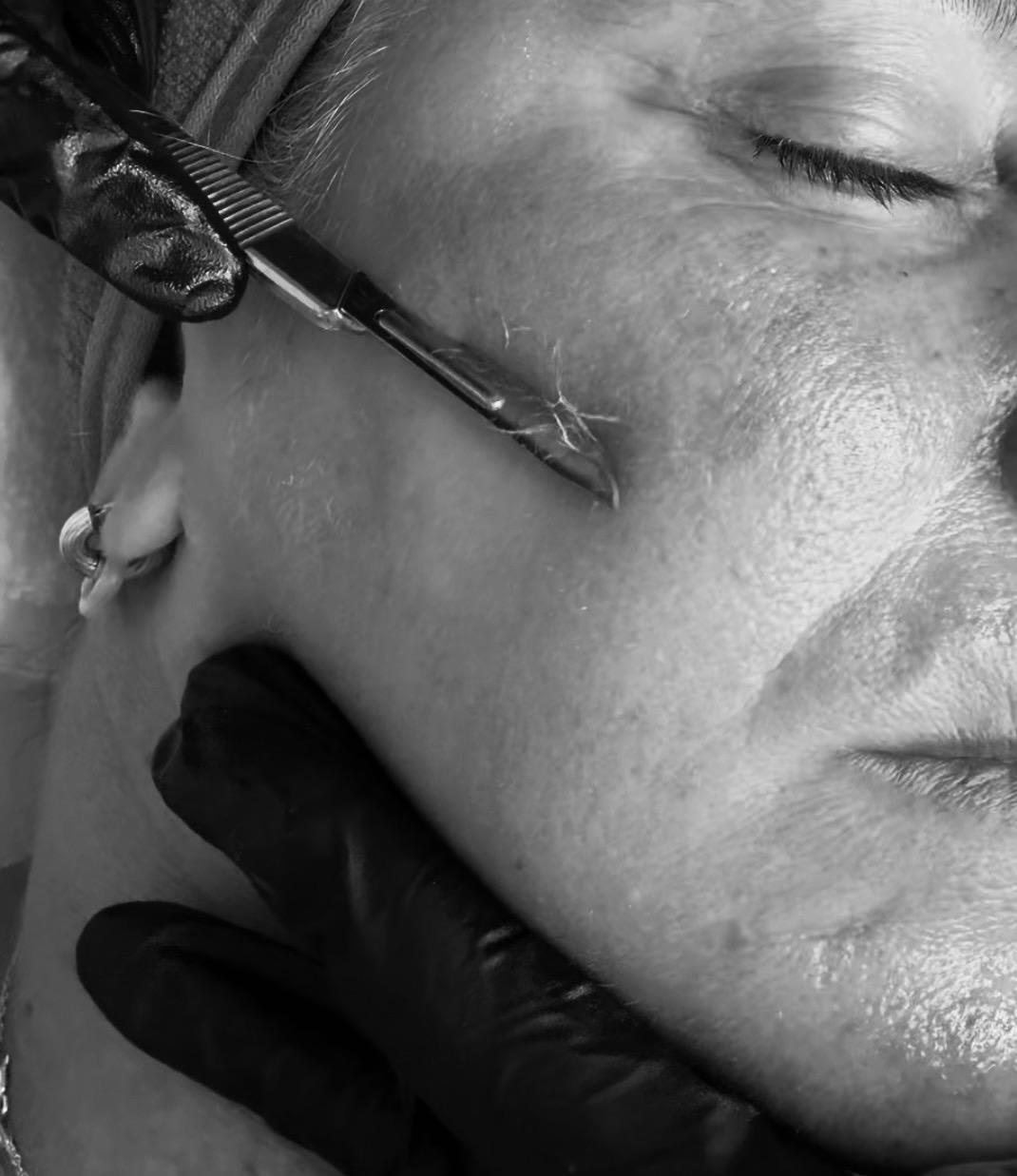 Limpieza + Dermaplaning