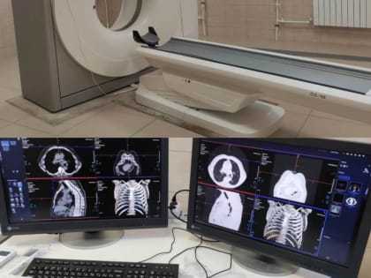 Почти 3 500 исследований на новом цифровом оборудовании выполнили в Богородской ЦРБ