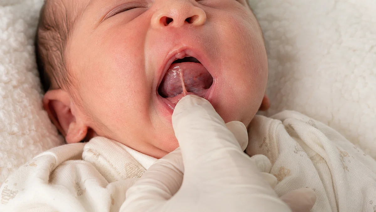 Close-up of a gentle pediatric examination checking a newborn baby's lingual frenulum for tongue-tie tightness.