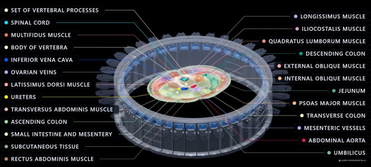 L'anneau de capteurs du scanner Midjourney et la coupe anatomique reconstruite