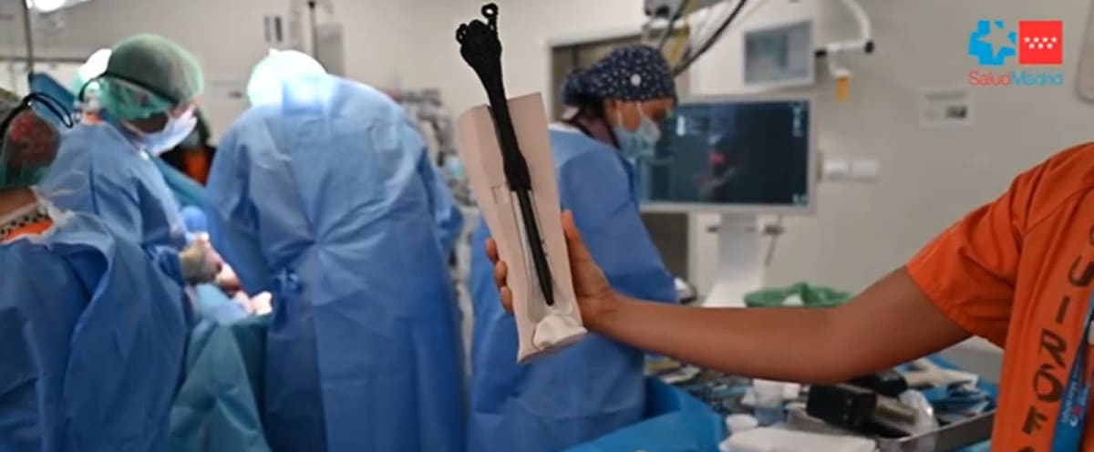 Proteză personalizată din titan pentru picior, implant medical inovator
