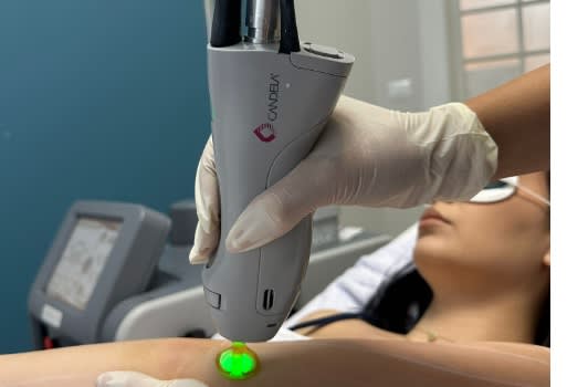 Procedură Sofwave pentru lifting facial non-invaziv în Timișoara