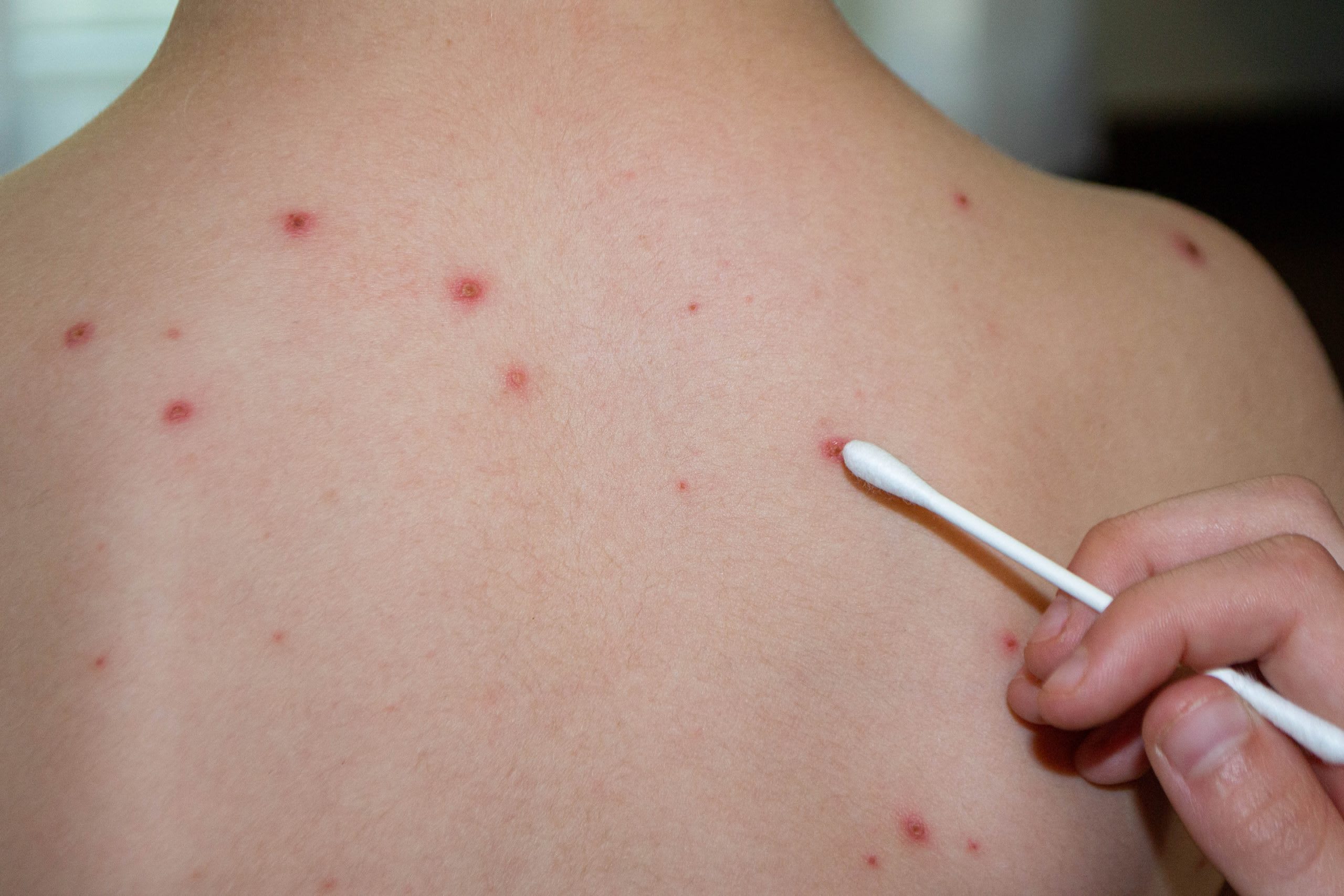Prof. Doina Azoicăi discutând despre vaccinare