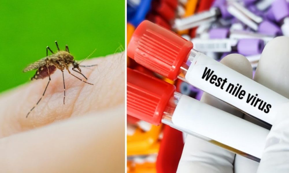 Virus West Nile