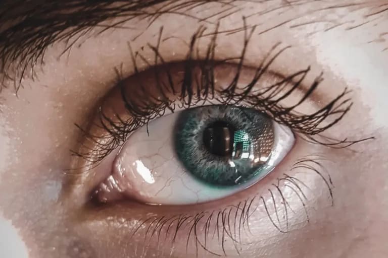 Persoană care aplică picături oftalmice, disconfort ocular Persoană care aplică picături oftalmice, disconfort ocular