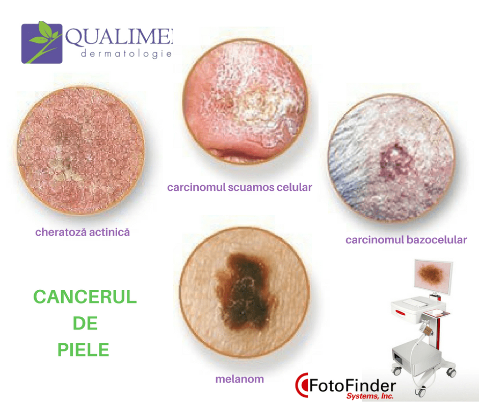 Medicul dermatolog examinează pielea pacientului în cabinet