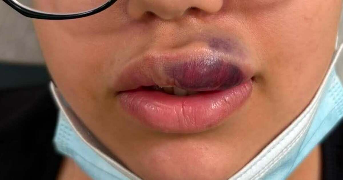 Femeie în sala de spital, echipamente medicale, urgență estetică Femeie în sala de spital, echipamente medicale, urgență estetică