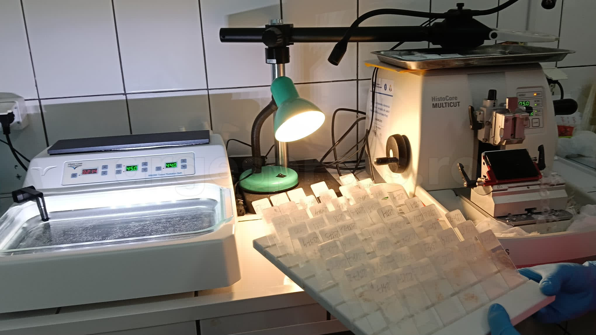 Aparatură medicală modernă pentru diagnosticarea cancerului