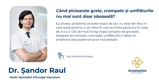 Tratament varice Cluj: când picioarele grele și crampele nu mai sunt doar oboseală